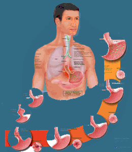 Evoluci�n de la Esofagitis